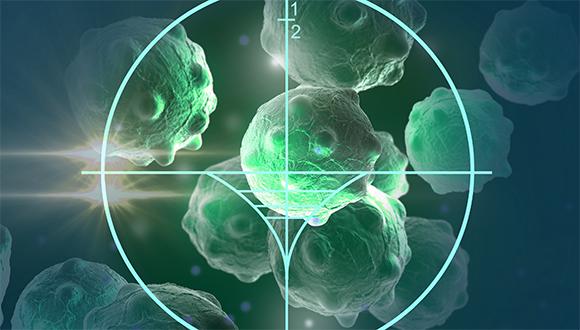 החיישן החכם שיאפשר למנתחים לזהות ולהסיר את כל תאי הגידול הסרטני החיישן החכם שיאפשר למנתחים לזהות ולהסיר את כל תאי הגידול הסרטני