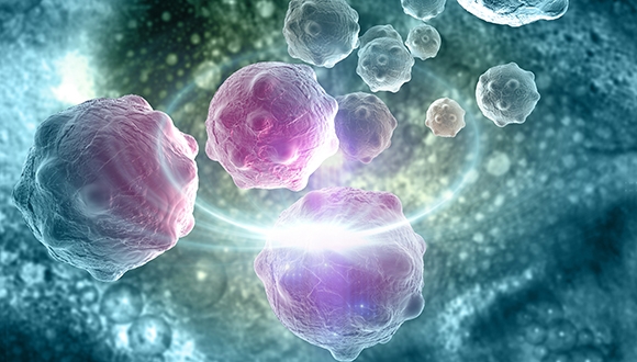 תרופות נגד חרדה ודלקת צמצמו הופעה של גרורות סרטניות תרופות נגד חרדה ודלקת צמצמו הופעה של גרורות סרטניות